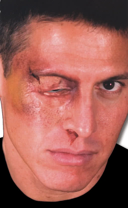 Geschwollenes Auge Wunde