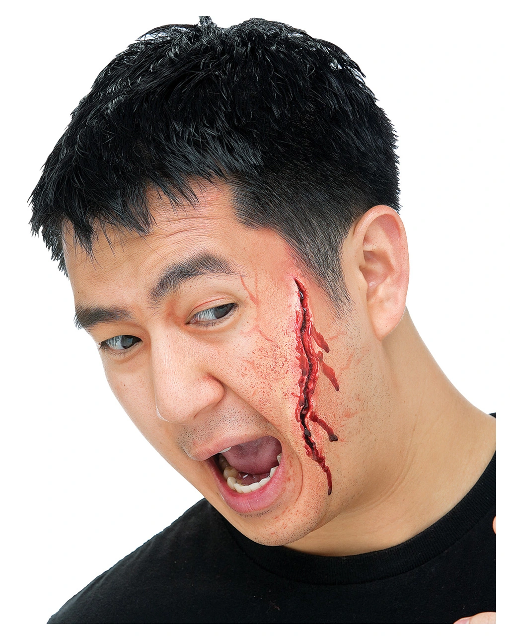 Tiefe Schnittwunde 3 Tiefe Schnittwunde